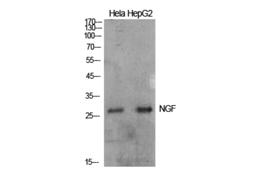 Western blot - NGF Polyclonal Antibody from Signalway Antibody (41931) - Antibodies.com