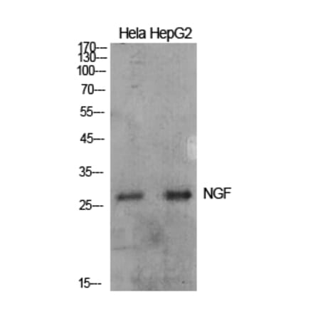 Western blot - NGF Polyclonal Antibody from Signalway Antibody (41931) - Antibodies.com