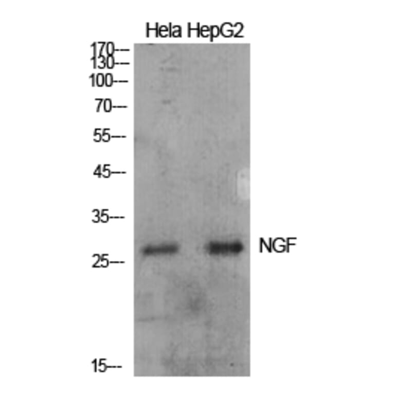 Western blot - NGF Polyclonal Antibody from Signalway Antibody (41931) - Antibodies.com