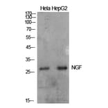 Western blot - NGF Polyclonal Antibody from Signalway Antibody (41931) - Antibodies.com