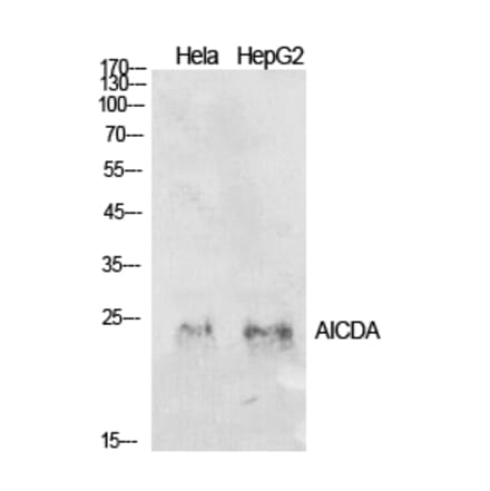 Western blot - AID Polyclonal Antibody from Signalway Antibody (41932) - Antibodies.com
