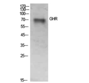 Western blot - GHR Polyclonal Antibody from Signalway Antibody (41939) - Antibodies.com