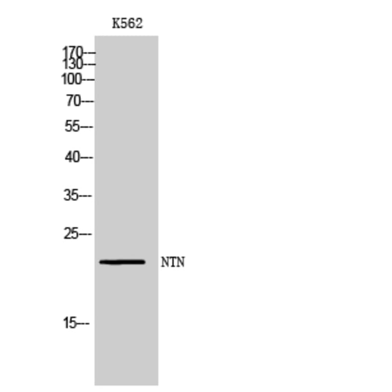 Western blot - NTN Polyclonal Antibody from Signalway Antibody (42013) - Antibodies.com