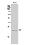 Western blot - NTN Polyclonal Antibody from Signalway Antibody (42013) - Antibodies.com
