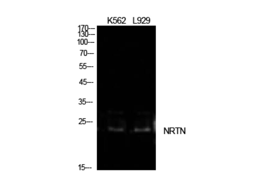 Western blot - NTN Polyclonal Antibody from Signalway Antibody (42013) - Antibodies.com