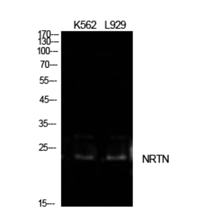 Western blot - NTN Polyclonal Antibody from Signalway Antibody (42013) - Antibodies.com