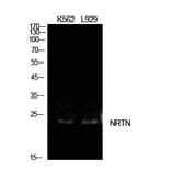 Western blot - NTN Polyclonal Antibody from Signalway Antibody (42013) - Antibodies.com