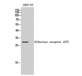 Western blot - Olfactory receptor 10T2 Polyclonal Antibody from Signalway Antibody (41265) - Antibodies.com