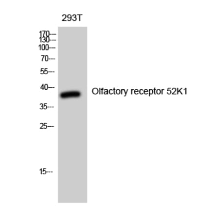 Western blot - Olfactory receptor 52K1 Polyclonal Antibody from Signalway Antibody (41279) - Antibodies.com