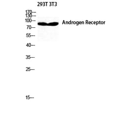 Western blot - AR Polyclonal Antibody from Signalway Antibody (40610) - Antibodies.com