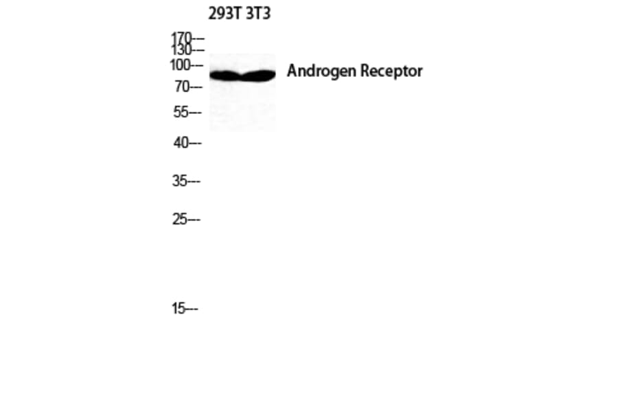 Western blot - AR Polyclonal Antibody from Signalway Antibody (40610) - Antibodies.com