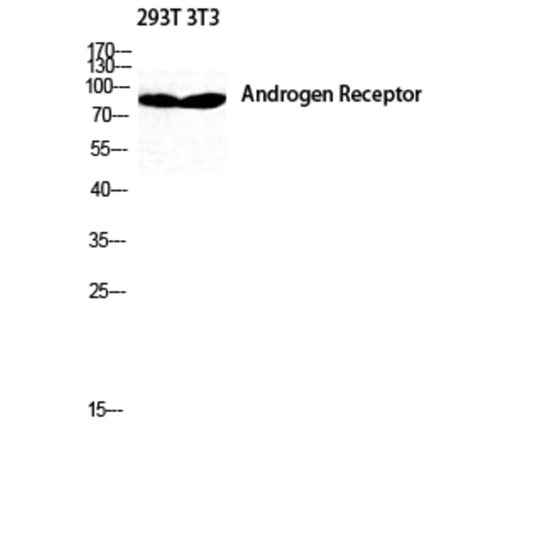 Western blot - AR Polyclonal Antibody from Signalway Antibody (40610) - Antibodies.com