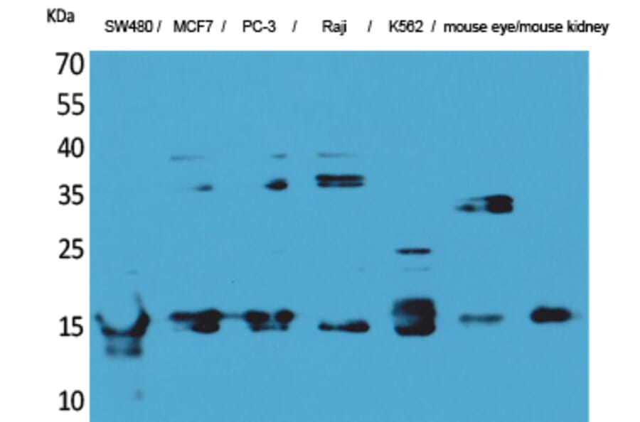 Western blot - MK Polyclonal Antibody from Signalway Antibody (41586) - Antibodies.com