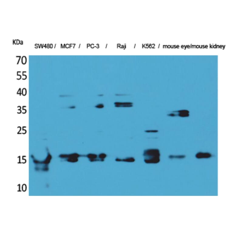 Western blot - MK Polyclonal Antibody from Signalway Antibody (41586) - Antibodies.com