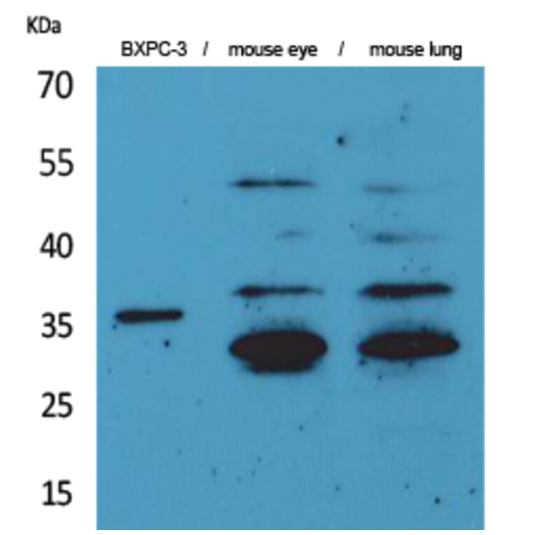 Western blot - TF Polyclonal Antibody from Signalway Antibody (41603) - Antibodies.com