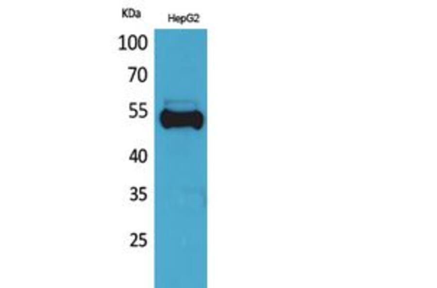 Western blot - Ub Polyclonal Antibody from Signalway Antibody (41812) - Antibodies.com
