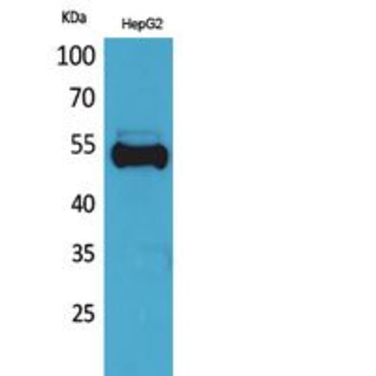 Western blot - Ub Polyclonal Antibody from Signalway Antibody (41812) - Antibodies.com