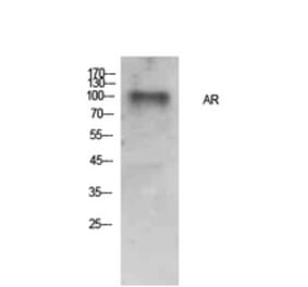 Western blot - AR Polyclonal Antibody from Signalway Antibody (41904) - Antibodies.com