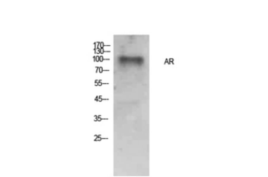 Western blot - AR Polyclonal Antibody from Signalway Antibody (41904) - Antibodies.com