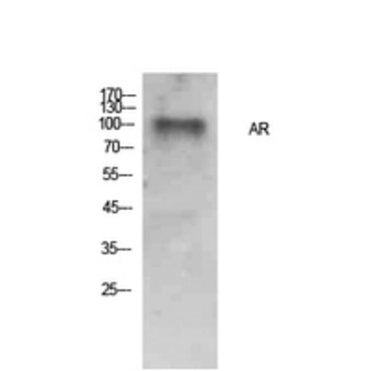 Western blot - AR Polyclonal Antibody from Signalway Antibody (41904) - Antibodies.com