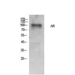 Western blot - AR Polyclonal Antibody from Signalway Antibody (41904) - Antibodies.com