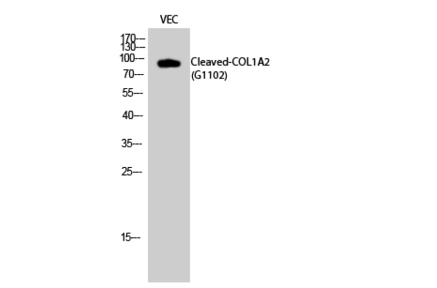 Western blot - Cleaved-COL1A2 (G1102) Polyclonal Antibody from Signalway Antibody (40512) - Antibodies.com