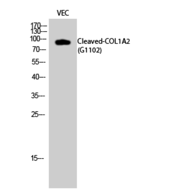 Western blot - Cleaved-COL1A2 (G1102) Polyclonal Antibody from Signalway Antibody (40512) - Antibodies.com