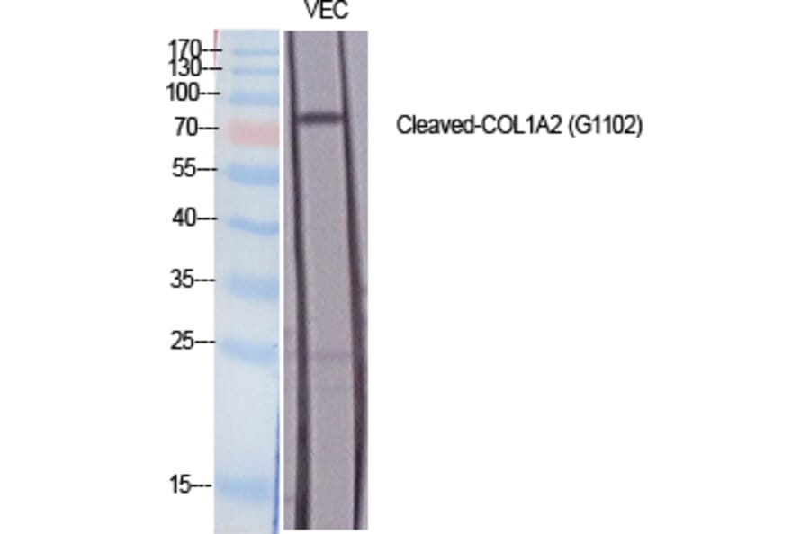 Western blot - Cleaved-COL1A2 (G1102) Polyclonal Antibody from Signalway Antibody (40512) - Antibodies.com