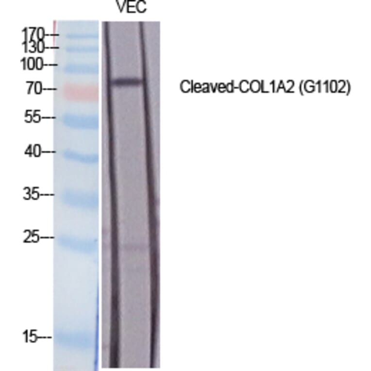Western blot - Cleaved-COL1A2 (G1102) Polyclonal Antibody from Signalway Antibody (40512) - Antibodies.com