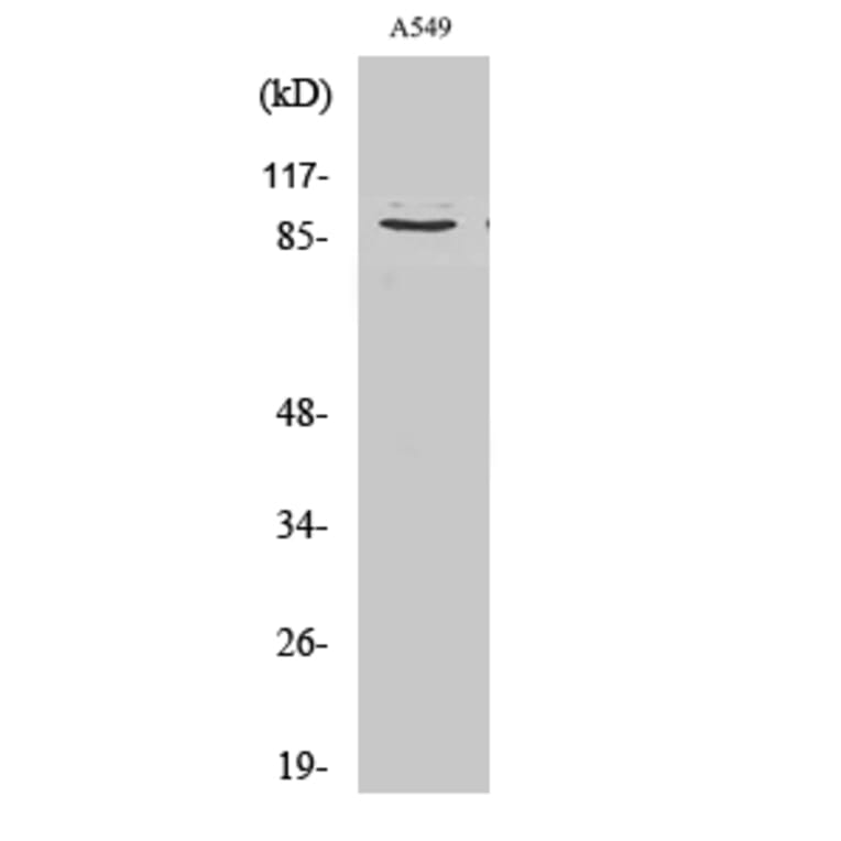 Western blot - Cleaved-COL3A1 (G1221) Polyclonal Antibody from Signalway Antibody (40513) - Antibodies.com