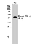 Western blot - Cleaved-MMP-12 (G106) Polyclonal Antibody from Signalway Antibody (40515) - Antibodies.com