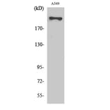 Western blot - Fatty Acid Synthase Polyclonal Antibody from Signalway Antibody (40921) - Antibodies.com