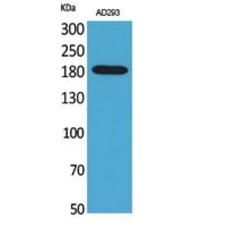 Western blot - Macroglobulin α-2 Polyclonal Antibody from Signalway Antibody (41755) - Antibodies.com