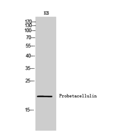 Western blot - Probetacellulin Polyclonal Antibody from Signalway Antibody (42006) - Antibodies.com