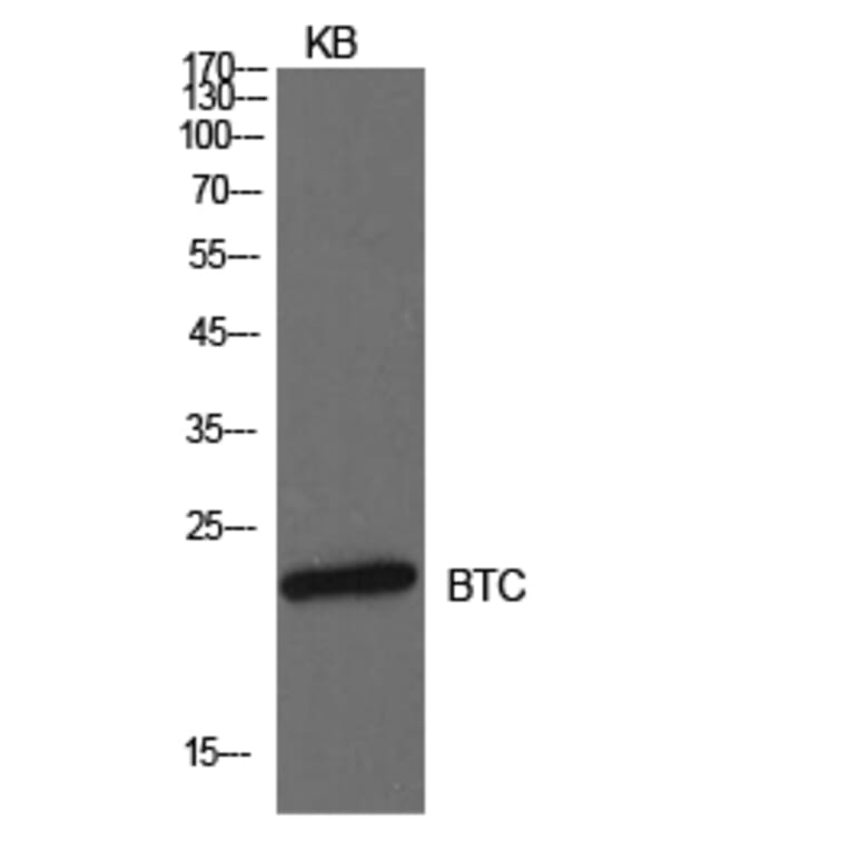 Western blot - Probetacellulin Polyclonal Antibody from Signalway Antibody (42006) - Antibodies.com