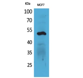 Western blot - Cytokeratin 14 Polyclonal Antibody from Signalway Antibody (41582) - Antibodies.com