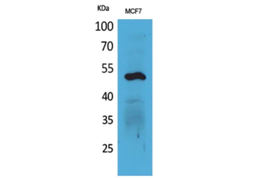 Western blot - Cytokeratin 14 Polyclonal Antibody from Signalway Antibody (41582) - Antibodies.com