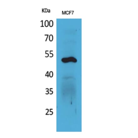 Western blot - Cytokeratin 14 Polyclonal Antibody from Signalway Antibody (41582) - Antibodies.com