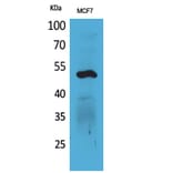 Western blot - Cytokeratin 14 Polyclonal Antibody from Signalway Antibody (41582) - Antibodies.com