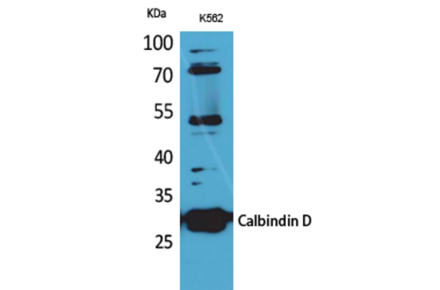 Western blot - Calbindin D28K Polyclonal Antibody from Signalway Antibody (41617) - Antibodies.com