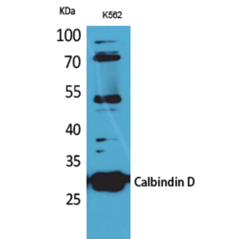 Western blot - Calbindin D28K Polyclonal Antibody from Signalway Antibody (41617) - Antibodies.com