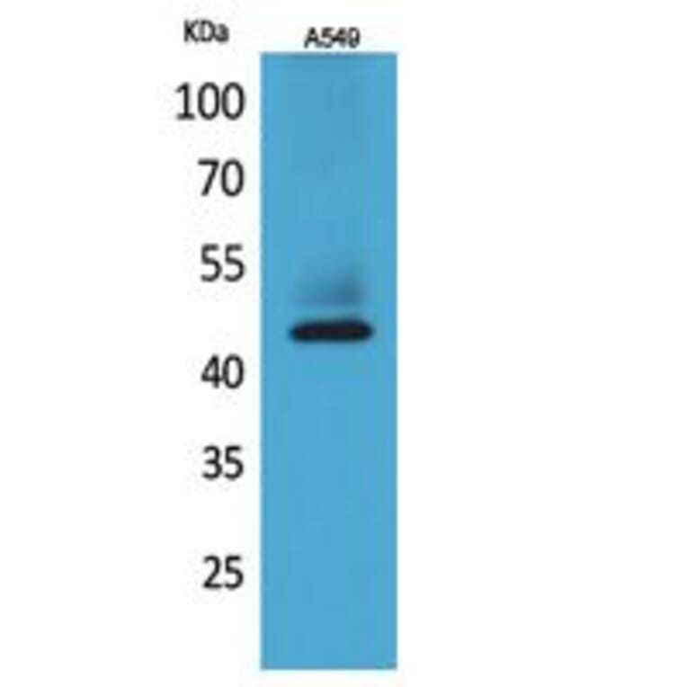 Western blot - Cytokeratin 19 Polyclonal Antibody from Signalway Antibody (41740) - Antibodies.com