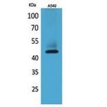 Western blot - Cytokeratin 19 Polyclonal Antibody from Signalway Antibody (41740) - Antibodies.com
