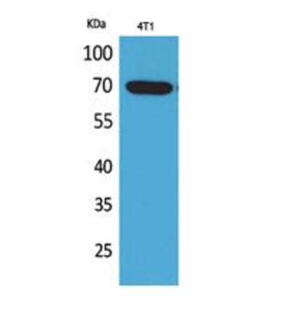 Western blot - Amphiphysin II Polyclonal Antibody from Signalway Antibody (41743) - Antibodies.com