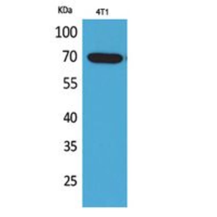 Western blot - Amphiphysin II Polyclonal Antibody from Signalway Antibody (41743) - Antibodies.com