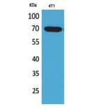 Western blot - Amphiphysin II Polyclonal Antibody from Signalway Antibody (41743) - Antibodies.com