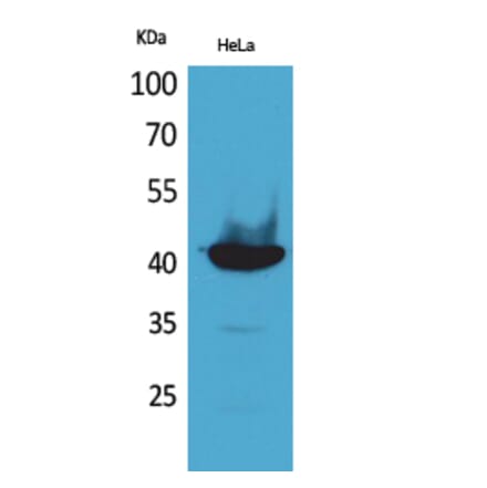 Western blot - Cyclophilin D Polyclonal Antibody from Signalway Antibody (41559) - Antibodies.com