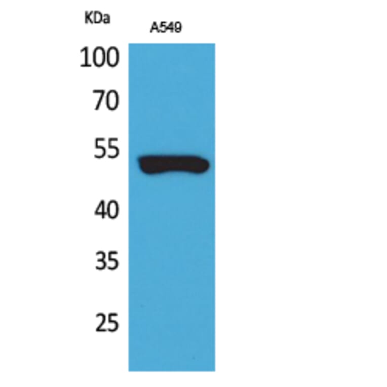 Western blot - Cytokeratin 8 Polyclonal Antibody from Signalway Antibody (41722) - Antibodies.com