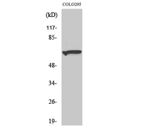 Western blot - Myotubularin Polyclonal Antibody from Signalway Antibody (41195) - Antibodies.com
