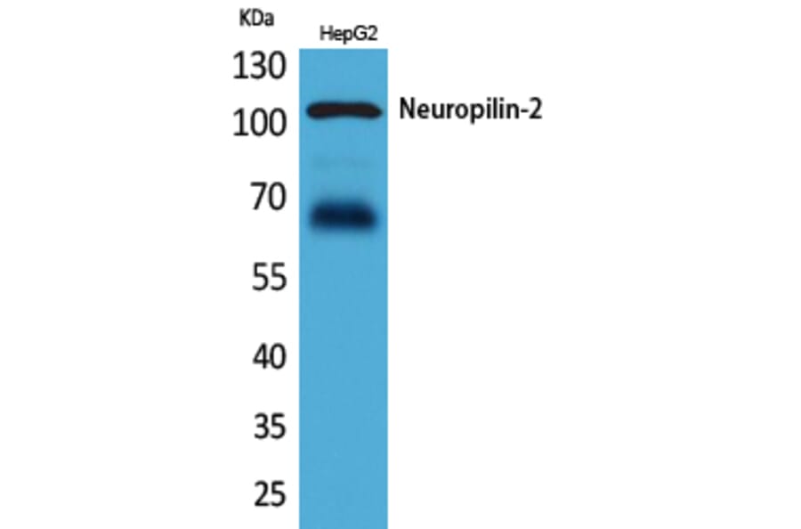 Western blot - Neuropilin-2 Polyclonal Antibody from Signalway Antibody (41638) - Antibodies.com